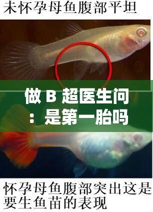 做 B 超医生问：是第一胎吗？探寻 B 超检查背后的故事