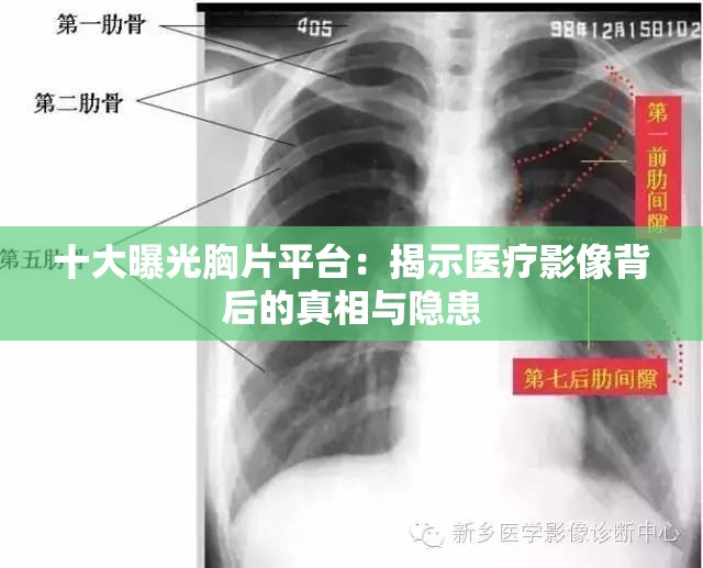 十大曝光胸片平台：揭示医疗影像背后的真相与隐患