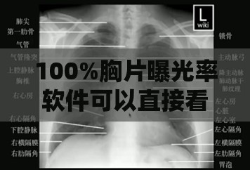 100%胸片曝光率软件可以直接看：为医疗诊断带来便捷新体验