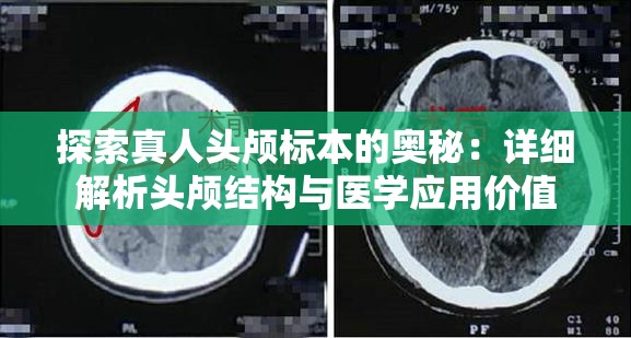 探索真人头颅标本的奥秘：详细解析头颅结构与医学应用价值